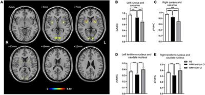 The Enhanced Interhemispheric Functional Connectivity in the Striatum Is Related to the Cognitive Impairment in Individuals With White Matter Hyperintensities